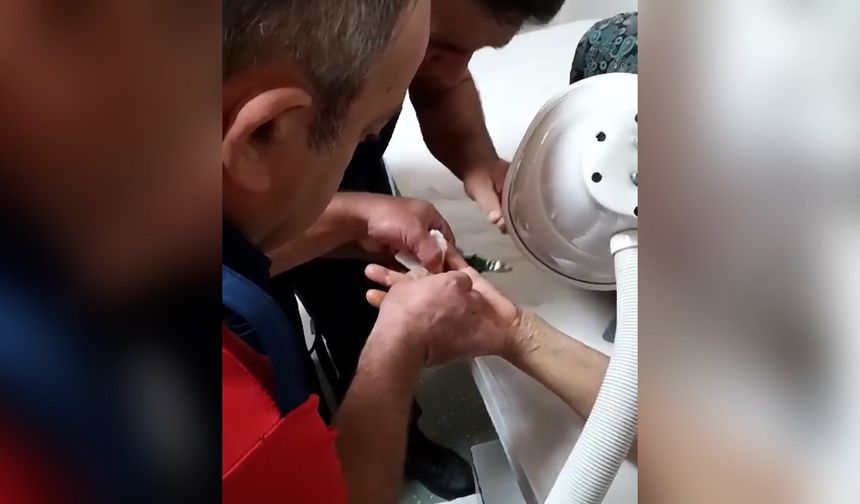 Yüzüğe sıkışan parmağı itfaiye ekipleri kurtardı